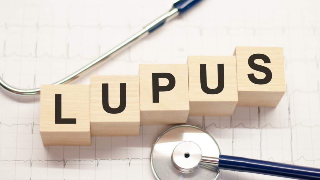 Lupus - International Magazine Kreol Lupus