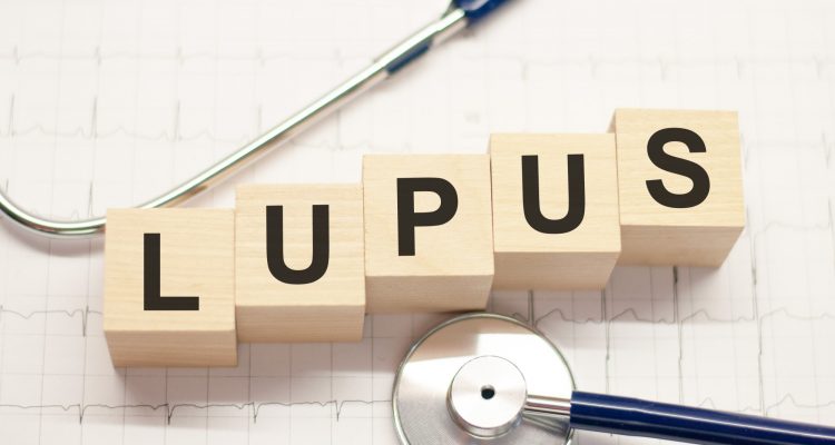 Lupus - International Magazine Kreol Lupus